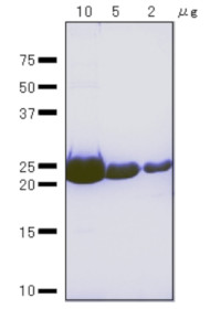 RuvA (protein, positive control) in the group Antibodies, Bacterial/Fungal at Agrisera AB (Antibodies for research) (AS21 4543P)